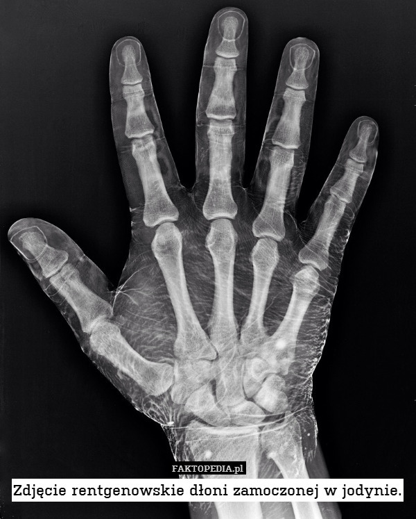 Zdjęcie rentgenowskie dłoni zamoczonej