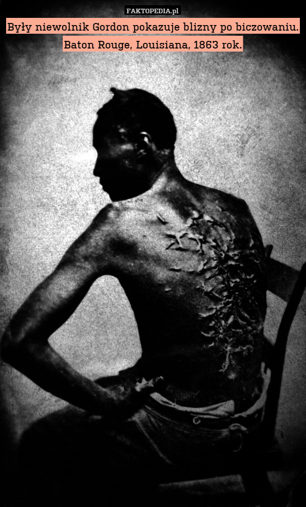Były niewolnik Gordon pokazuje blizny po biczowaniu.
Baton Rouge, Louisiana,