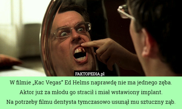 W filmie "Kac Vegas" Ed Helms naprawdę nie ma jednego zęba. Aktor