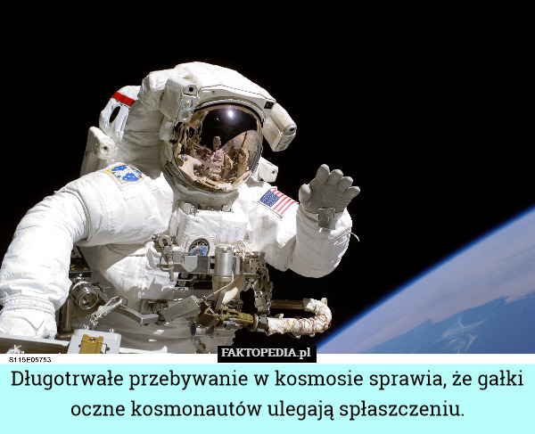 Długotrwałe przebywanie w kosmosie sprawia, że gałki oczne kosmonautów ulegają