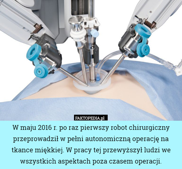 W maju 2016 r. po raz pierwszy robot chirurgiczny przeprowadził w pełni