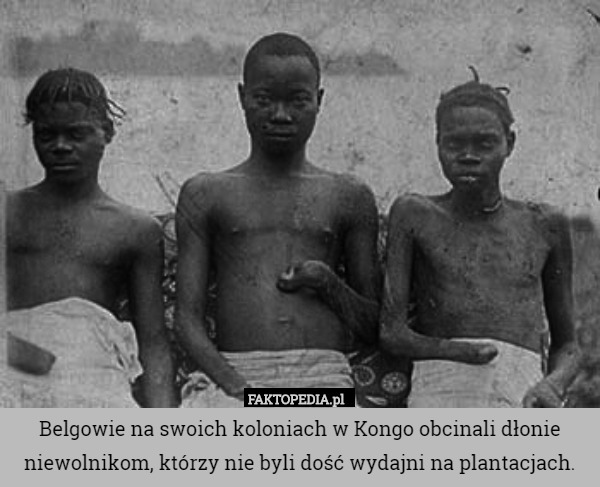 Belgowie na swoich koloniach w Kongo obcinali dłonie niewolnikom, którzy