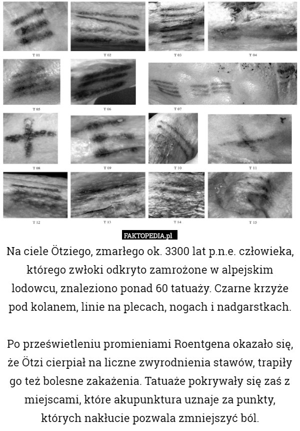 Na ciele Ötziego, zmarłego ok. 3300 lat p.n.e. człowieka, którego zwłoki
