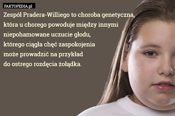 Zespół Pradera-Williego to choroba genetyczna,
która u chorego powoduje