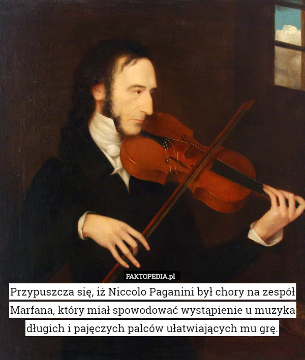 Przypuszcza się, iż Niccolo Paganini był chory na zespół Marfana, który