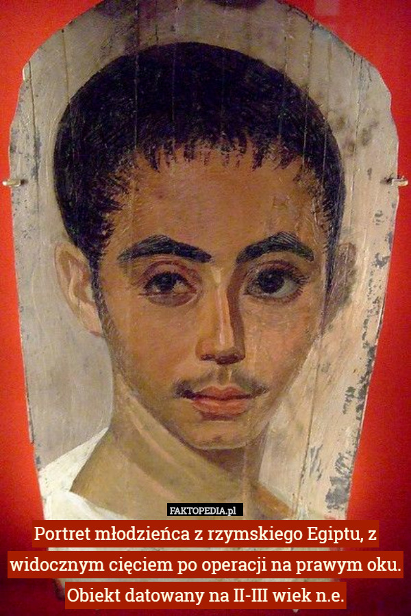 Portret młodzieńca z rzymskiego Egiptu, z widocznym cięciem po operacji...
