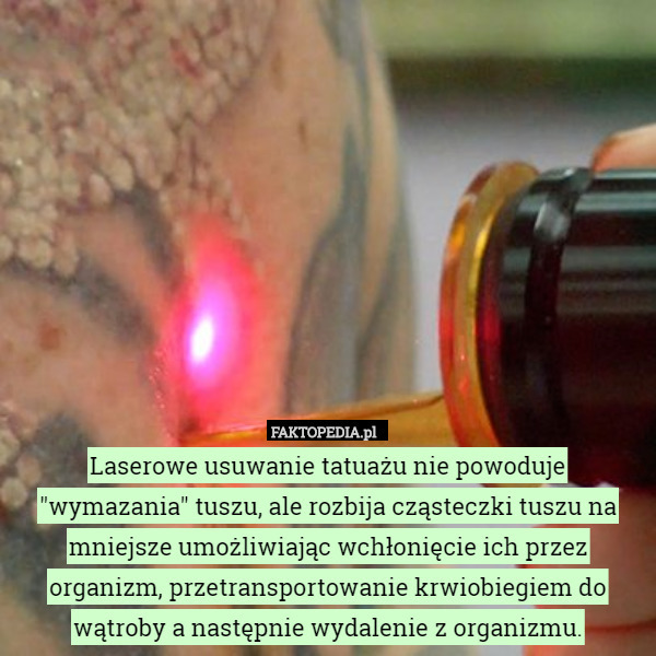 Laserowe usuwanie tatuażu nie powoduje "wymazania" tuszu, ale