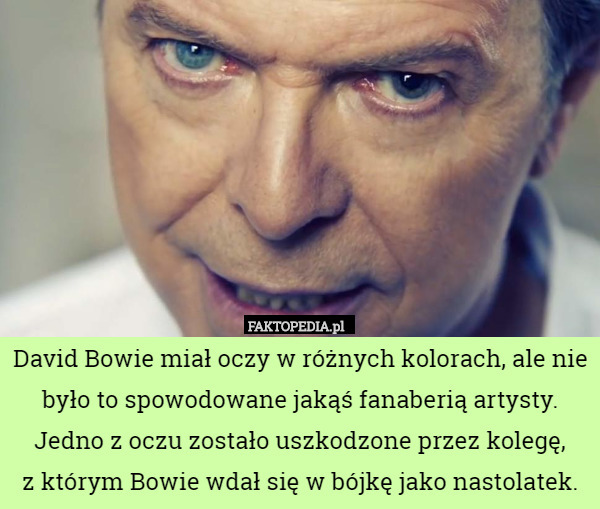 David Bowie miał oczy w różnych kolorach, ale nie było to spowodowane jakąś