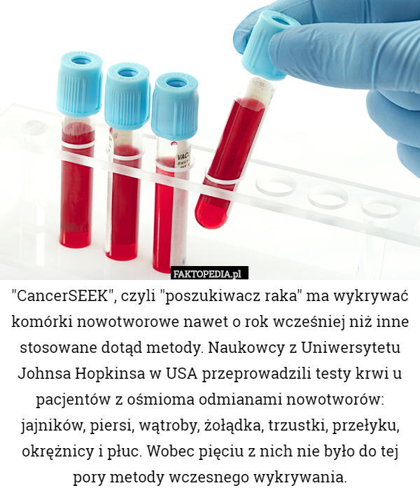 "CancerSEEK", czyli "poszukiwacz raka" ma wykrywać komórki