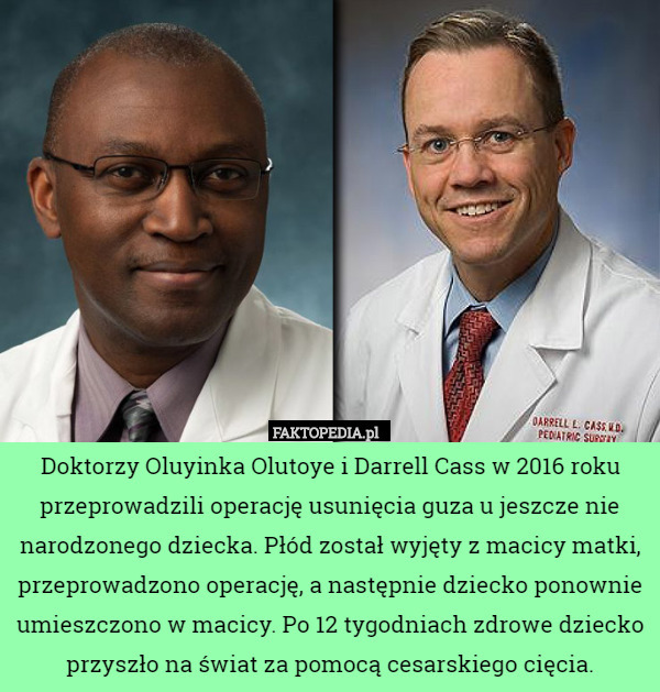 Doktorzy Oluyinka Olutoye i Darrell Cass w 2016 roku przeprowadzili operację...