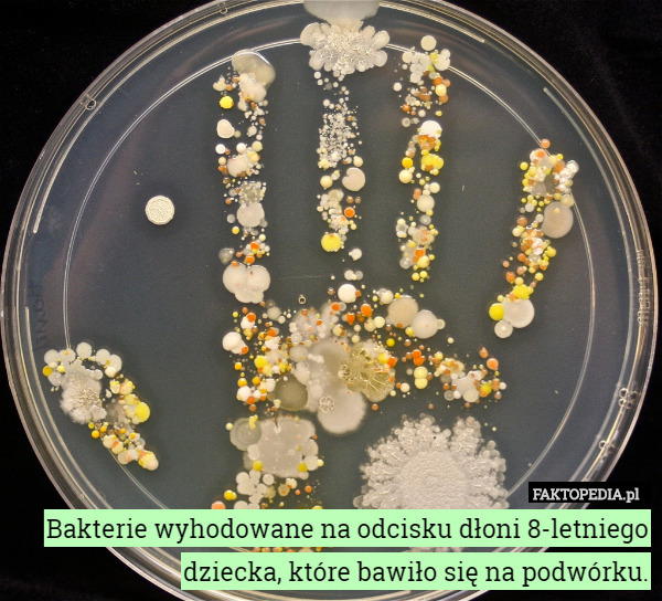 Bakterie wyhodowane na odcisku dłoni 8-letniego dziecka, które bawiło się...
