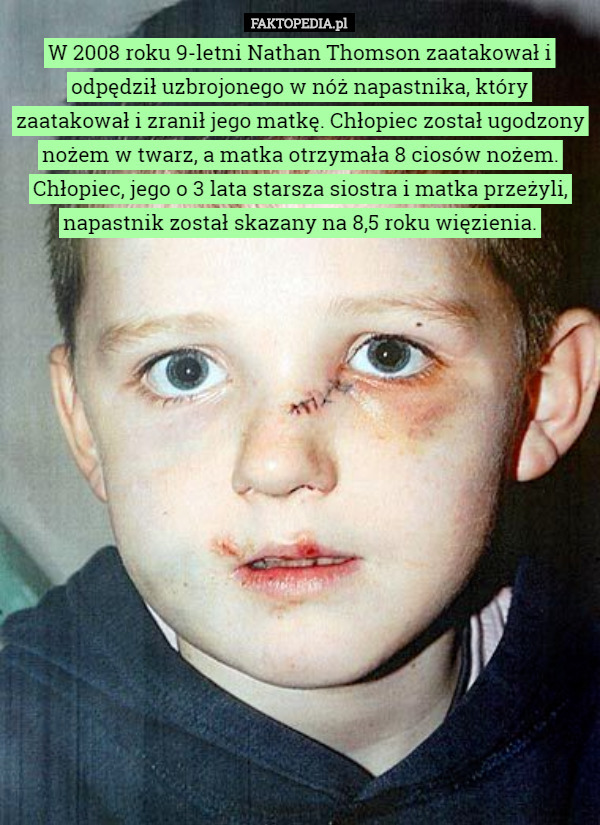 W 2008 roku 9-letni Nathan Thomson zaatakował i odpędził uzbrojonego w nóż...