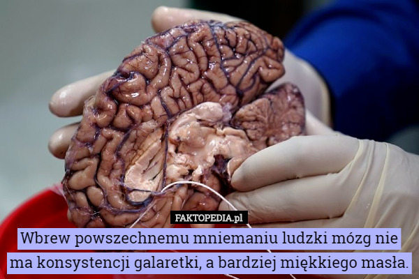 Wbrew powszechnemu mniemaniu ludzki mózg nie ma konsystencji galaretki...