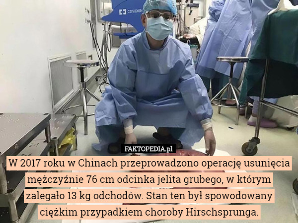 W 2017 roku w Chinach przeprowadzono operację usunięcia mężczyźnie 76 cm...