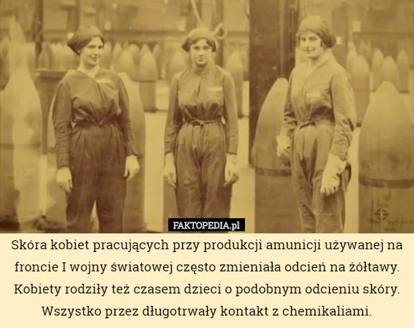 Skóra kobiet pracujących przy produkcji amunicji używanej na froncie I wojny