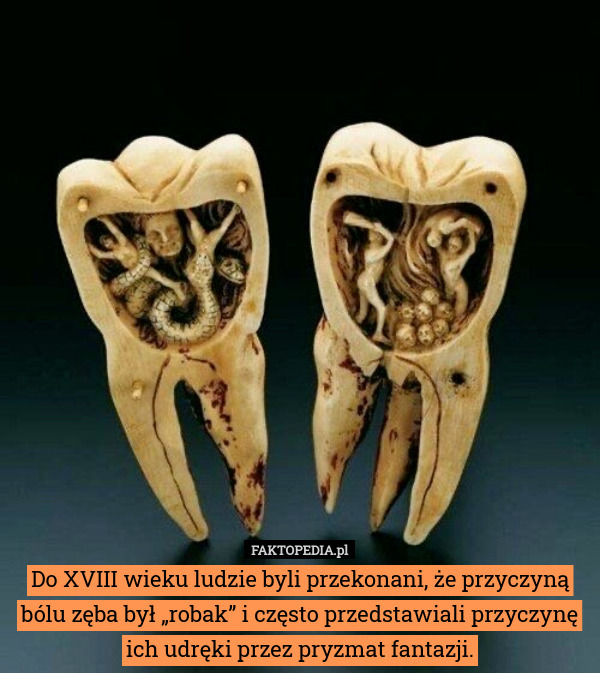 Do XVIII wieku ludzie byli przekonani, że przyczyną bólu zęba był „robak”