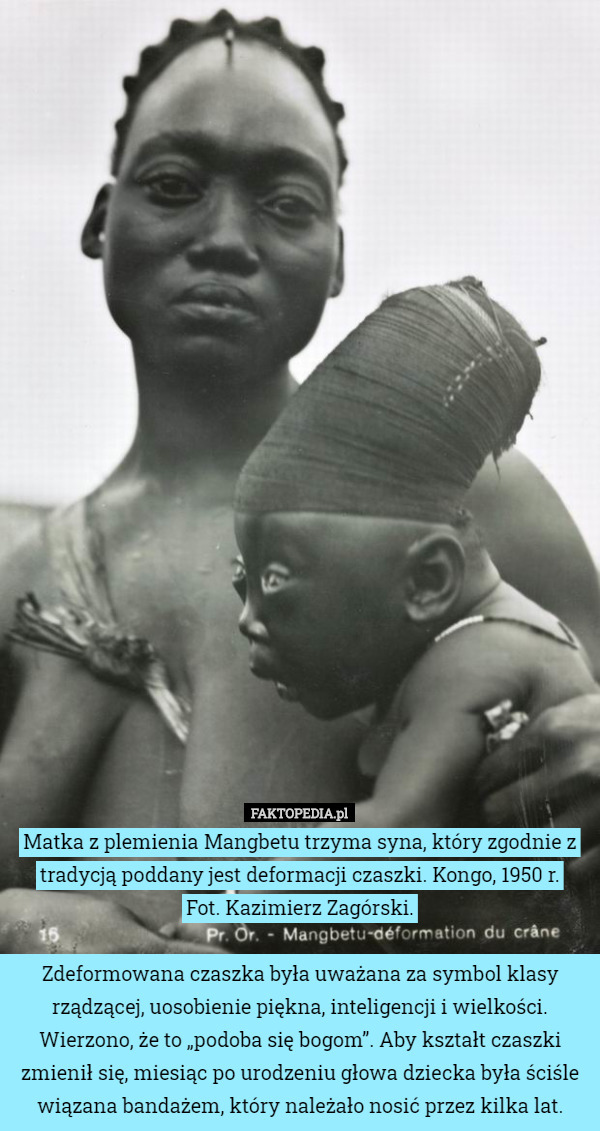 Matka z plemienia Mangbetu trzyma syna, który zgodnie z tradycją poddany...