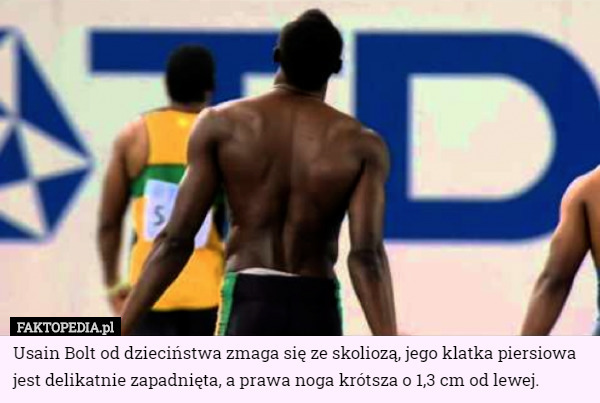 Usain Bolt od dzieciństwa zmaga się ze skoliozą , jego klatka...
