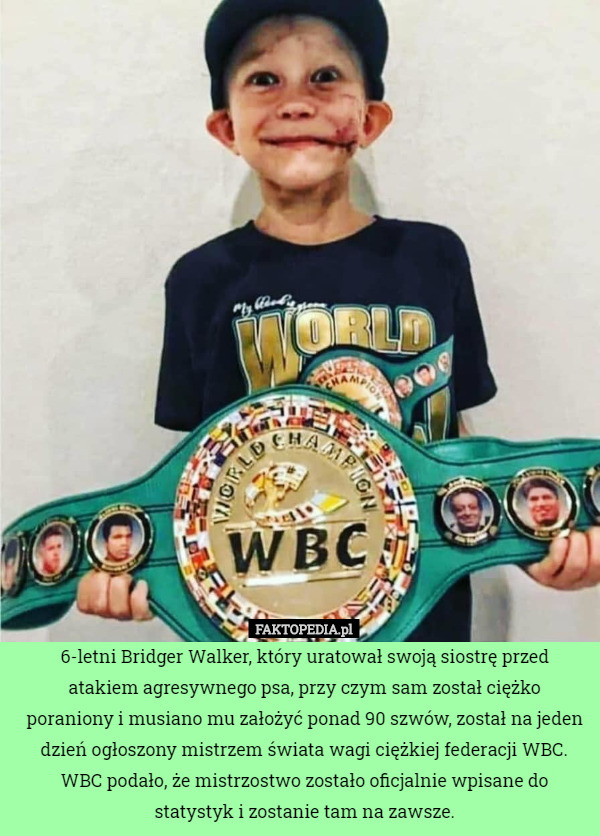 6-letni Bridger Walker, który uratował swoją siostrę przed atakiem agresywnego