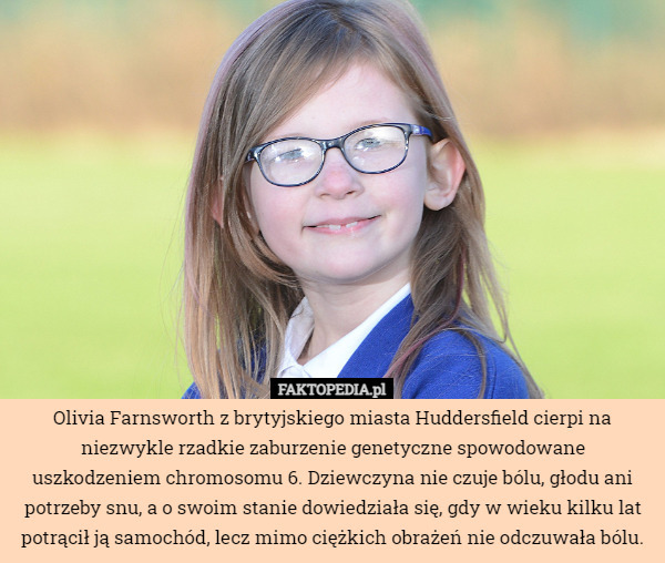 Olivia Farnsworth z brytyjskiego miasta Huddersfield cierpi na niezwykle...