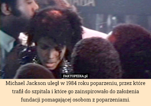 Michael Jackson uległ w 1984 roku poparzeniu, przez które trafił do szpitala