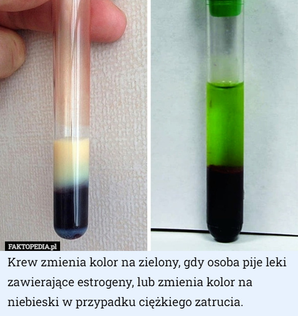 Krew zmienia kolor na zielony, gdy osoba pije leki zawierające estrogeny...