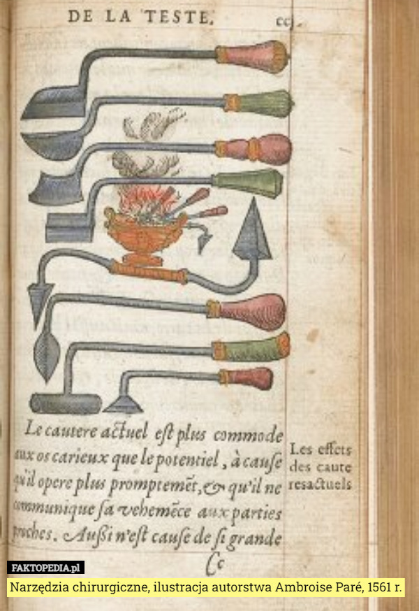 Narzędzia chirurgiczne, ilustracja autorstwa Ambroise Paré, 1561 r.