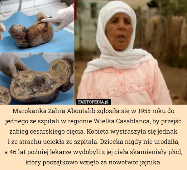 Marokanka Zahra Aboutalib zgłosiła się w 1955 roku do jednego ze szpitali...