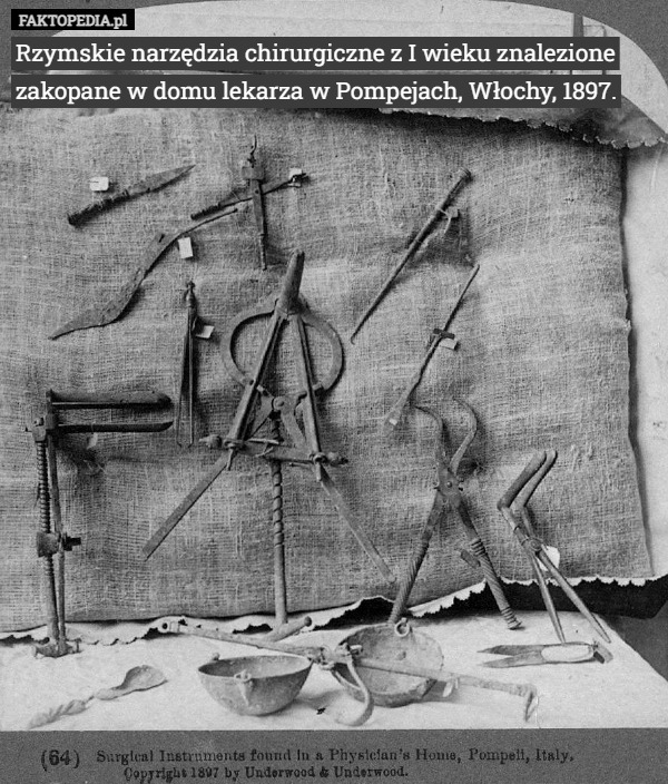 Rzymskie narzędzia chirurgiczne z I wieku znalezione zakopane w domu lekarza